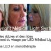 Traitement des rides et des ridules 2 par Led Médical Light System ®